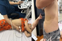 Chi 10 triệu cho con đi trại hè, mẹ ở Hà Nội sốc khi con bị bắt nạt