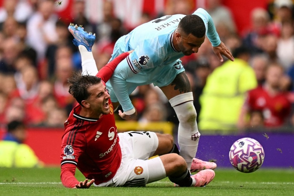 マンU、マンC戦前に大敗 - 2 Man Utd nhận tổn thất lớn trước màn so tài với Man City - 2