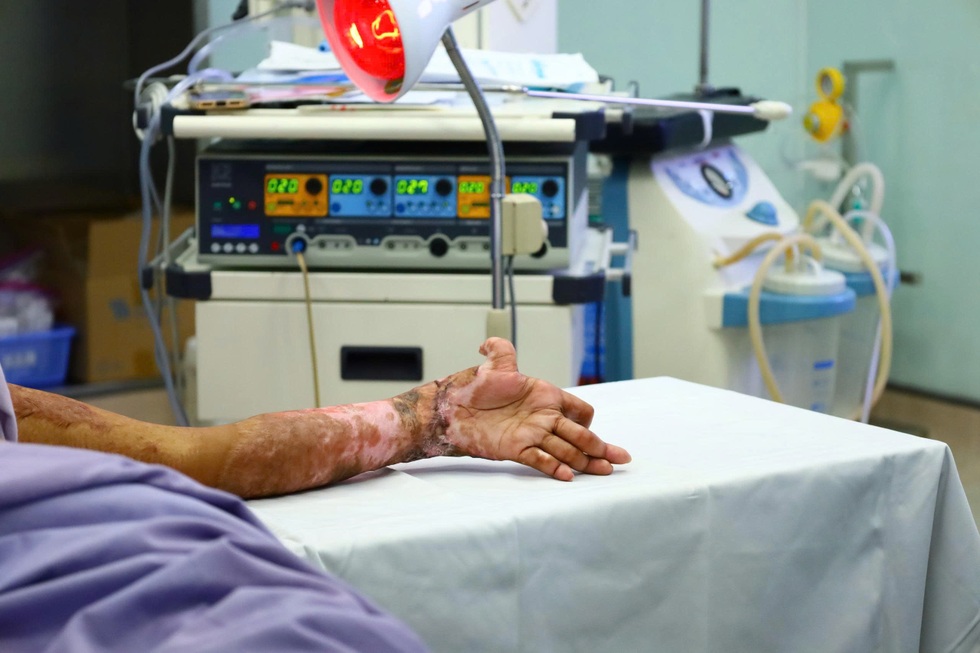 Những ca mổ “0 đồng” giúp hàng trăm người tìm lại hình hài sau biến cố - 9