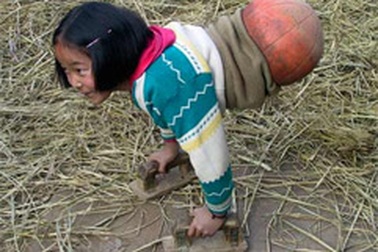 Xúc động vì nghị lực của cô bé khuyết tật (có video)