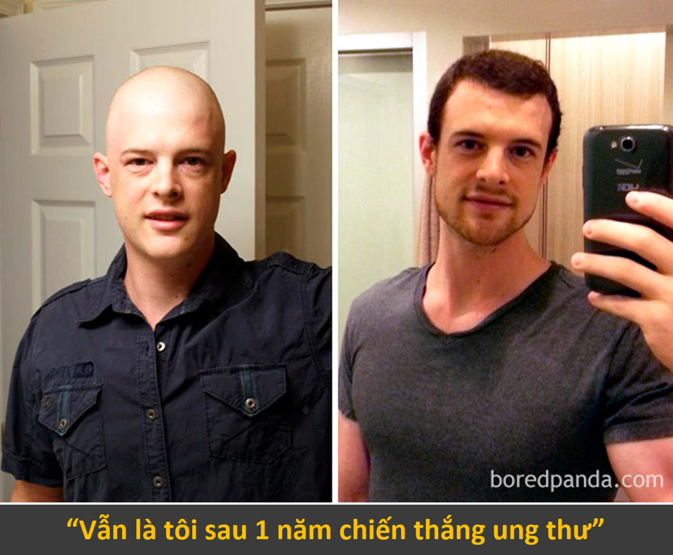 Màn lột xác ngoạn mục của những con người chiến thắng ung thư - 2 Màn lột xác ngoạn mục của những con người chiến thắng ung thư - 2