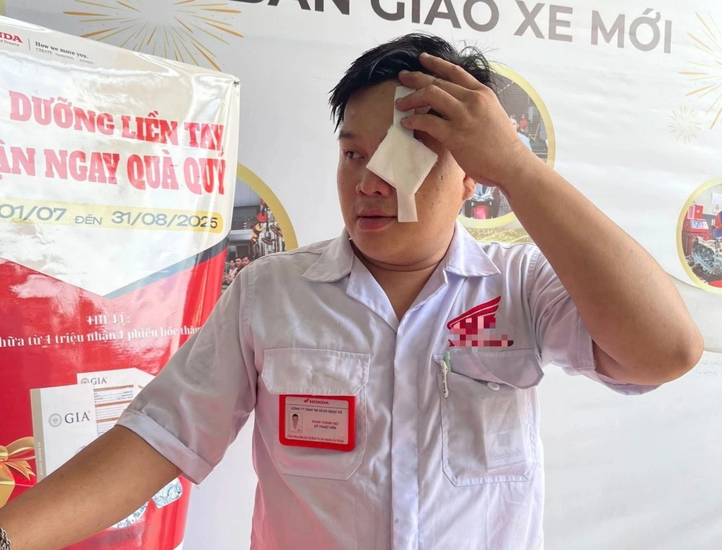 Xôn xao hình ảnh rắn chui vào xe máy, phun nọc độc vào thợ sửa xe ở TPHCM - 2 Xôn xao hình ảnh rắn chui vào xe máy, phun nọc độc vào thợ sửa xe ở TPHCM - 2