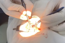 Tỉnh có số người hiến giác mạc nhiều nhất Việt Nam