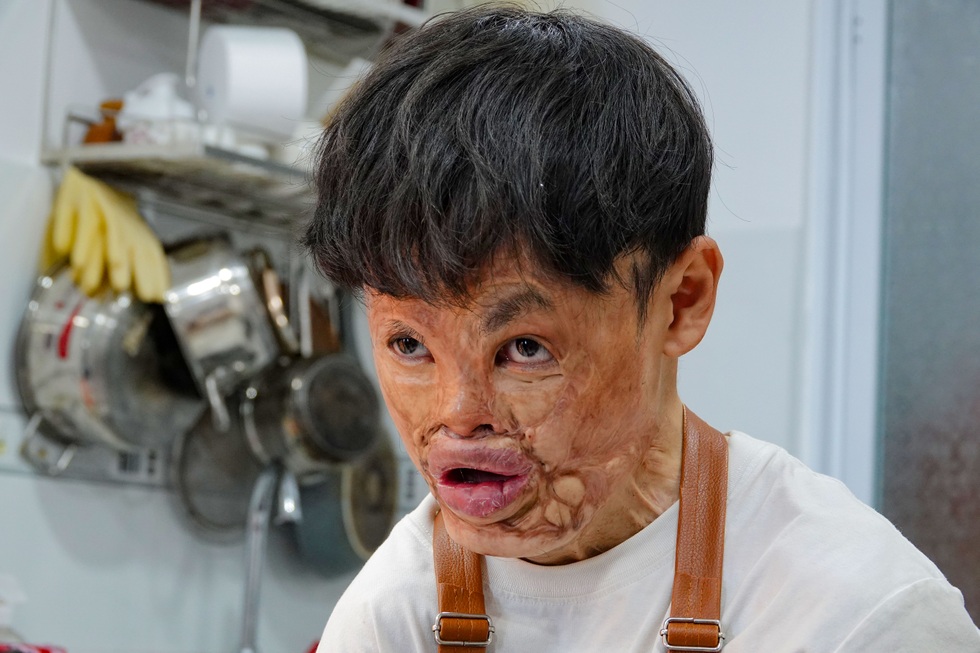 Chàng trai cháy cả gương mặt mở tiệm bánh bán... tình yêu - 11 Chàng trai cháy cả gương mặt mở tiệm bánh bán... tình yêu - 11