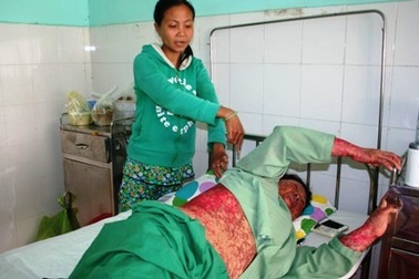 Làm đẹp đón tết, coi chừng “hết xuân” vì mỹ phẩm rởm