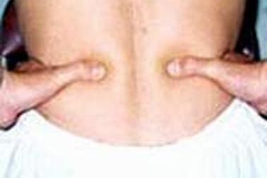 Cách xoa bóp chữa đau thắt lưng