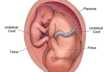 Làm gì khi thai đôi gặp “trục trặc”?