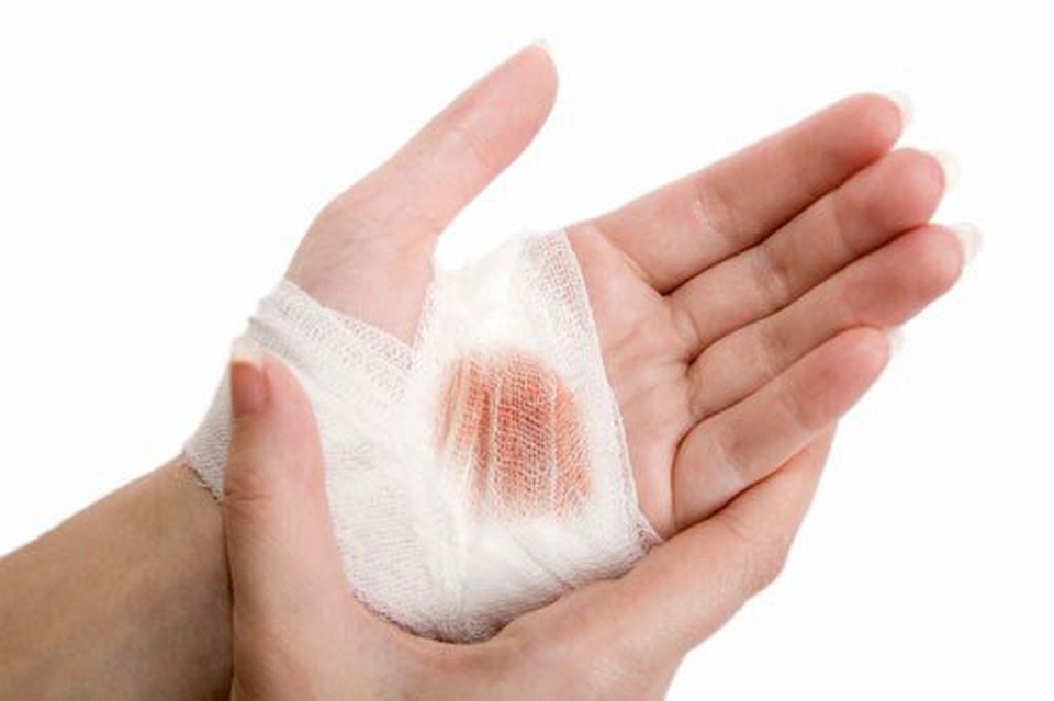 Mũi bỗng nhiên đỏ ửng có thể là lời cầu cứu của cơ thể khi gan gặp vấn đề - 3 Mũi bỗng nhiên đỏ ửng có thể là lời cầu cứu của cơ thể khi gan gặp vấn đề - 3