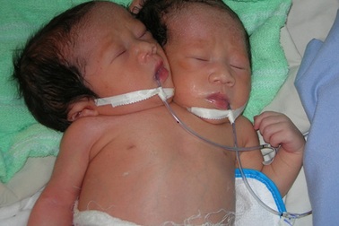 Để hết nỗi đau con dị tật...