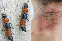 Chưa hết khổ vì muỗi, người Hà Nội lại bị kiến ba khoang "hành"