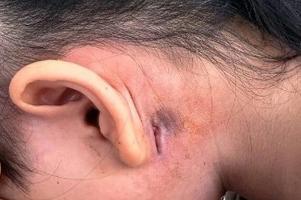 Phát hiện 2 ca bệnh truyền nhiễm nguy hiểm, ngành y tế chỉ đạo khẩn - 1 Phát hiện 2 ca bệnh truyền nhiễm nguy hiểm, ngành y tế chỉ đạo khẩn - 1