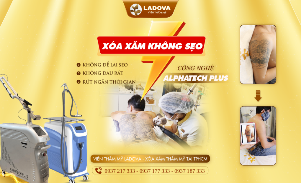 Viện Thẩm Mỹ Ladova xóa hình xăm không sẹo bằng laser - 2 Viện Thẩm Mỹ Ladova xóa hình xăm không sẹo bằng laser - 2