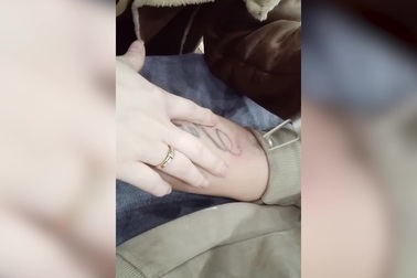 Chàng trai xóa hình xăm trên cánh tay để chuẩn bị sang Nhật làm việc.