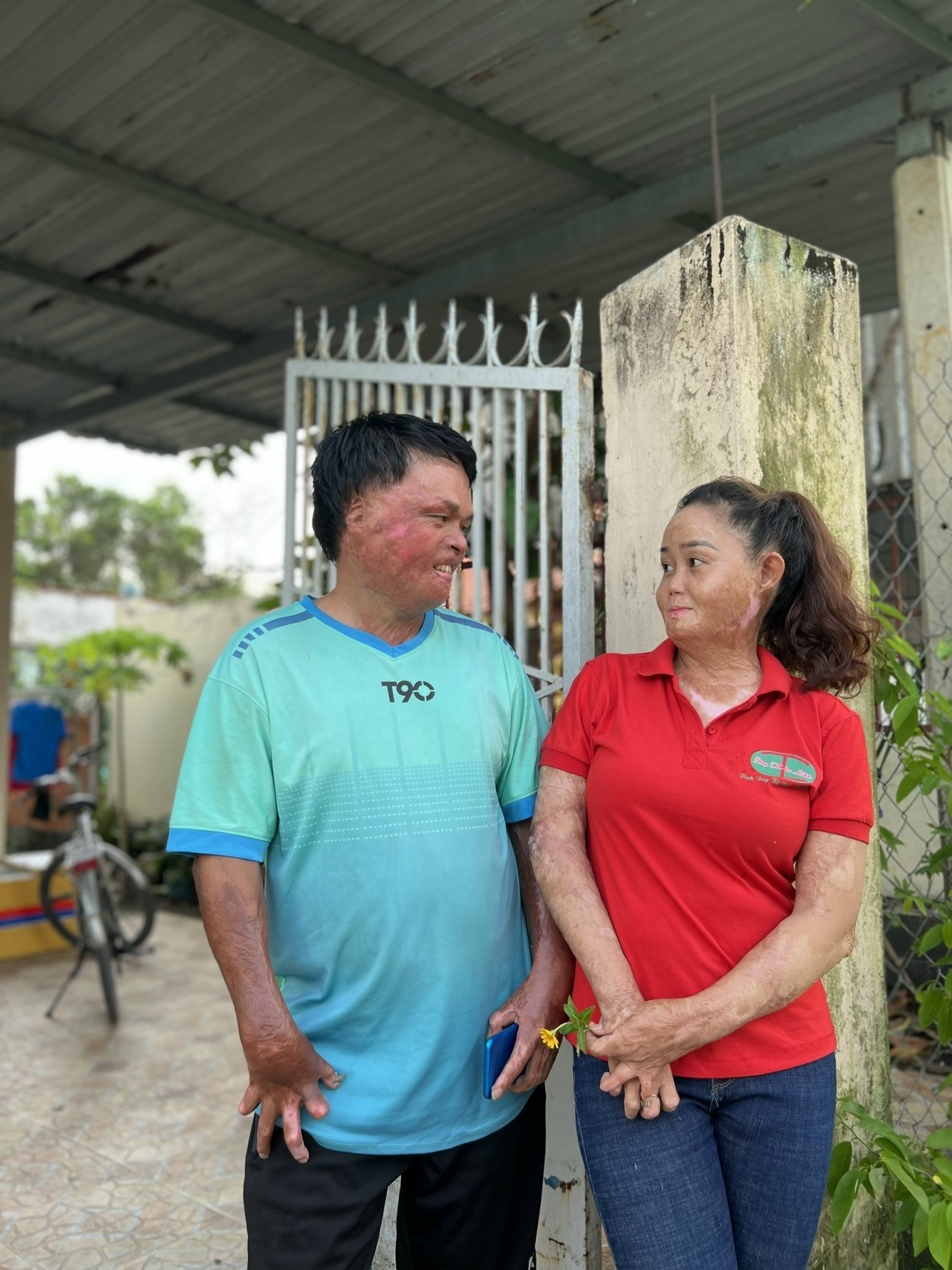 Tình yêu hồi sinh bà mẹ hai con từng bị chồng cũ thiêu sống - 4 Tình yêu hồi sinh bà mẹ hai con từng bị chồng cũ thiêu sống - 4