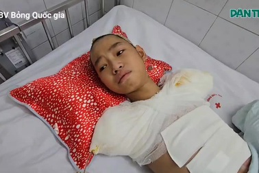 Bác sĩ kêu gọi giúp đỡ cậu bé lớp 7 phải cắt cụt tứ chi vì bỏng điện