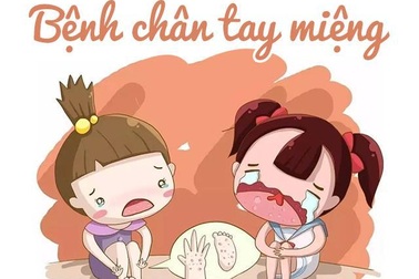 Bệnh tay chân miệng ở trẻ nhỏ và giải pháp độc đáo từ bộ đôi sản phẩm Subạc