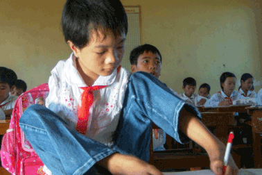 Vụ phụ cấp giáo viên dạy trẻ khuyết tật: Sở GD&ĐT hướng dẫn chi trả