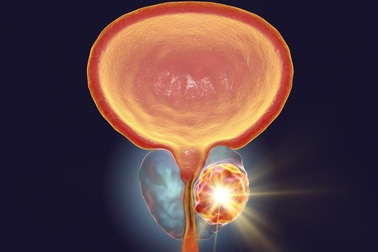 Phương pháp "2 trong 1": Vừa tiêu diệt ung thư vừa phục hồi thương tổn