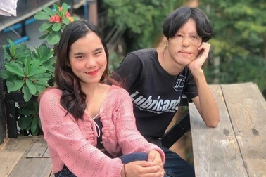 Chuyện tình vượt định kiến của chàng trai có gương mặt biến dạng