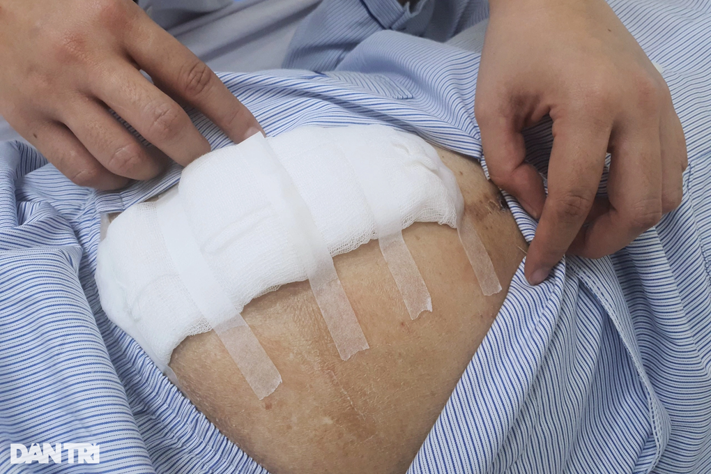Căn bệnh hiểm ở ruột gây nhiễm độc, có thể mất mạng chỉ trong 3 ngày - 2 Căn bệnh hiểm ở ruột gây nhiễm độc, có thể mất mạng chỉ trong 3 ngày - 2