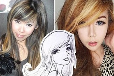 Phẫu thuật thẩm mỹ nhiều lần để có "gương mặt hoạt hình"