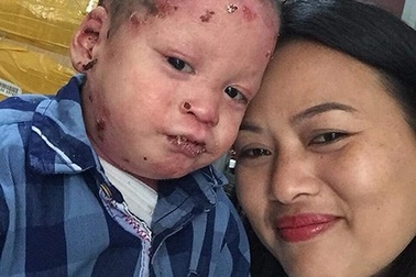 Mẹ của những đứa trẻ mang trên mình vết thương không bao giờ lành