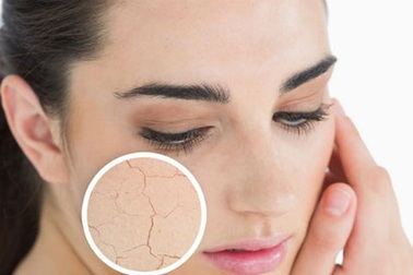 Các dấu hiệu lão hóa da mặt bạn cần biết!