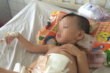 Bé 3 tuổi bị người tình của mẹ đạp vỡ đại tràng