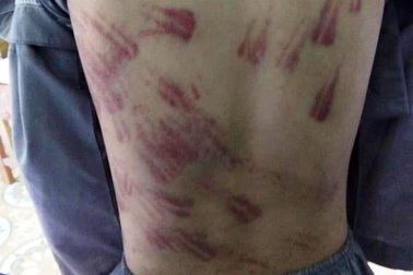 Cháu bé mồ côi không dám kể chuyện bị sư thầy bạo hành vì sợ bị... đánh chết!