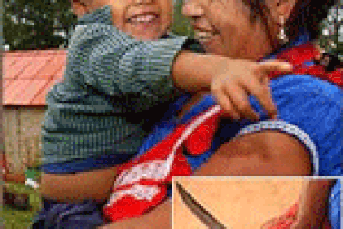 Tự mổ bụng để sinh con