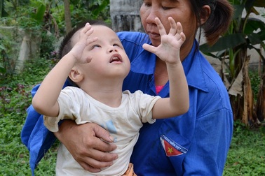 Thương bé 3 tuổi không cha, bị đục thủy tinh thể và tim bẩm sinh