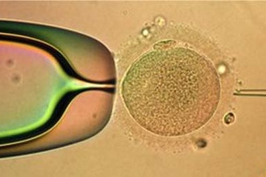 Nguy cơ biến chứng do thụ tinh ống nghiệm 