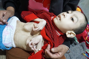 Đau nhói lòng cảnh cậu bé 15 năm nằm một chỗ, thân hình khô quắt