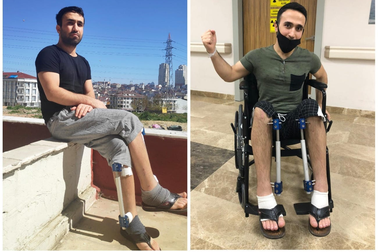 Đổi đời sau khi chi hơn 629 triệu đồng kéo dài chân gần 13cm