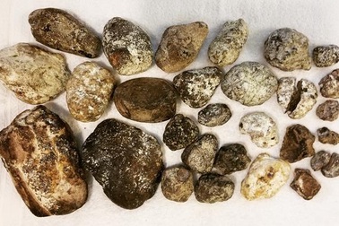 Hòn đá xấu xí, khúc gỗ mục nát bất ngờ có giá hàng chục tỷ đồng