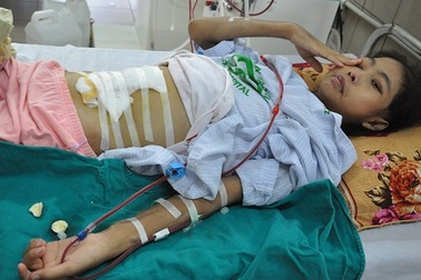 Người mẹ trẻ mắc bệnh Lupus đã không còn