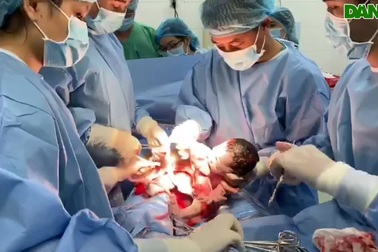 Mổ đẻ thành công cho sản phụ mắc chứng tăng đông máu hiếm gặp