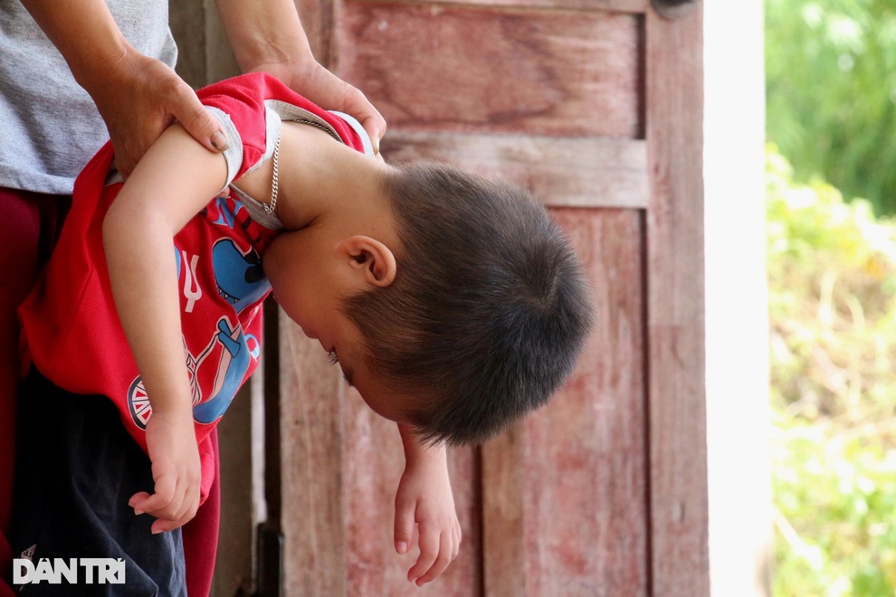 Bố tật nguyền, mẹ thiểu năng, thương bé trai 4 tuổi mắc bệnh hiểm nghèo - 2 Bố tật nguyền, mẹ thiểu năng, thương bé trai 4 tuổi mắc bệnh hiểm nghèo - 2