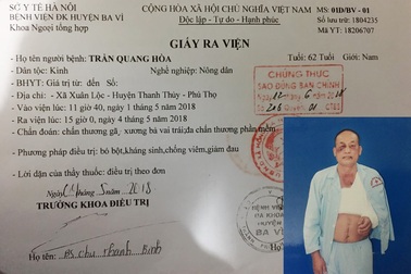 Bị đánh gãy xương bả vai còn bị xử phạt vi phạm hành chính?