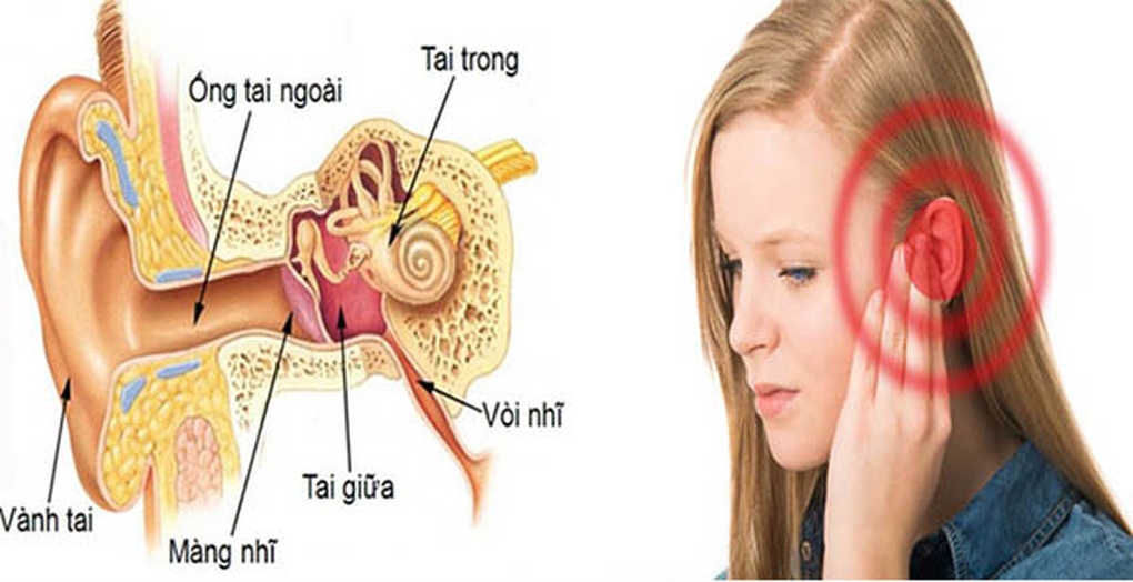 Các nguyên nhân gây đau tai và cách xử trí - 1 Các nguyên nhân gây đau tai và cách xử trí - 1