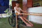 Tai nạn vỡ cột sống, liệt 2 chân, người đàn ông sợ làm khổ chị gái