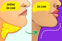 Điều gì xảy ra khi ăn 1 quả cam mỗi ngày?