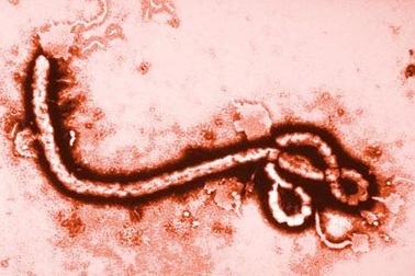 WHO khuyến cáo người khỏi Ebola kiêng sex trong 3 tháng