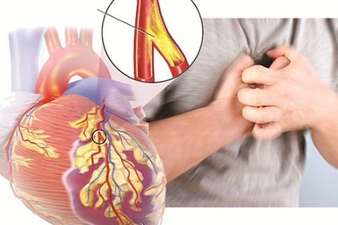 Mỹ cấp phép sử dụng thuốc tiểu đường trong điều trị suy tim