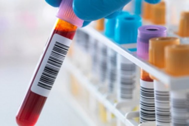 Đột phá: Phát hiện "thủ phạm" khiến bệnh AIDS không thể chữa khỏi