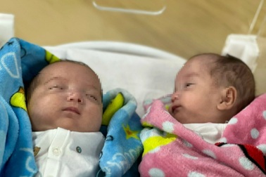 Cặp song sinh 25 tuần tuổi được nuôi dưỡng thành công