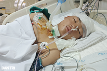 Bị xe bán tải tông trên đường đến lớp, tính mạng cậu bé lớp 8 nguy kịch