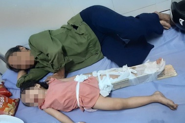 Phụ huynh “tố” học sinh gãy chân tại trường, hiệu trưởng trả lời vô cảm