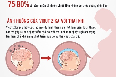 Infographics: Toàn cảnh về khả năng vi rút Zika "tấn công" thai phụ