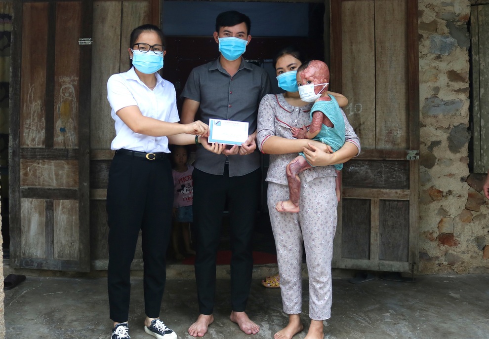 Cháu bé 2 tuổi bị bỏng xăng nặng được bạn đọc giúp đỡ gần 500 triệu đồng - 3 Cháu bé 2 tuổi bị bỏng xăng nặng được bạn đọc giúp đỡ gần 500 triệu đồng - 3